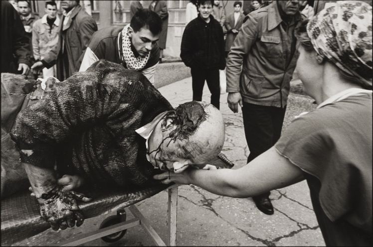 A wounded man is brought to Kosovo hospital, January 1994